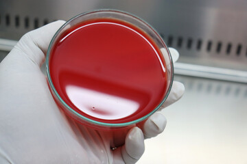 blood culture media for microorganisms identification