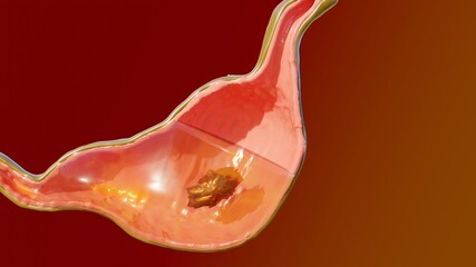 3d Illustration of Human Stomach Anatomy Digestion, 3D reander