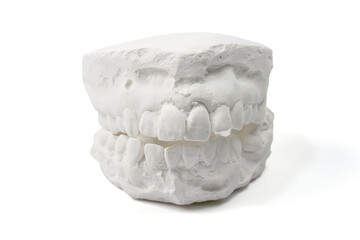Cast gypsum model plaster for dental molar teeth before braces in laboratory isolated on white background included clipping path.