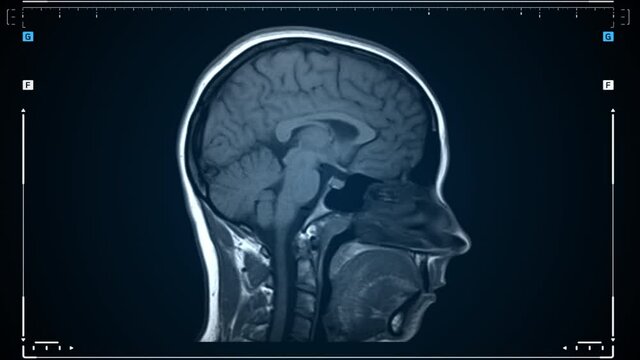 MRI scan of a human brain in motion. Scanning of brain magnetic resonance image. Diagnostic Medical Tool.