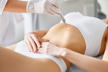 Obraz na płótnie Canvas Woman getting laser skin care treatment in clinic