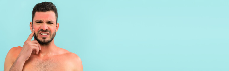 Obraz premium Worried shirtless man with sunburn looking at camera isolated on blue, banner