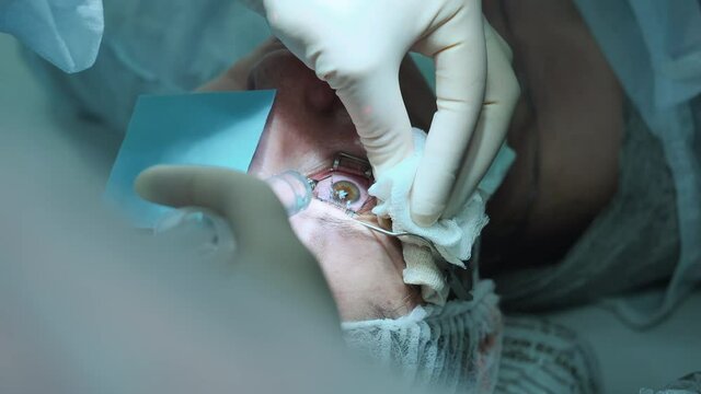 Doctor is pouring anesthetic fluid into patient's eye