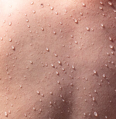Water drops on human skin as an abstract background.