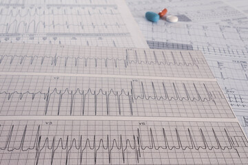colored pills on electrocardiograms with cardiac arrhythmias. heart medications. post covid heart...