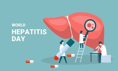 Concept of hepatitis A, B, C, D, cirrhosis, world hepatitis day. Tiny doctors treat the liver. vector illustration. - obrazy, fototapety, plakaty