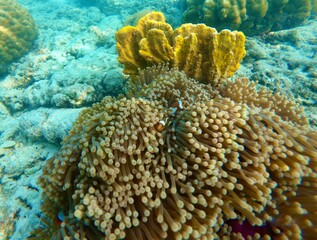 Coral bleaching by climate change. Dead and dying coral reef due to global warming.