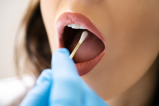 Mouth Swab DNA Test For Disease