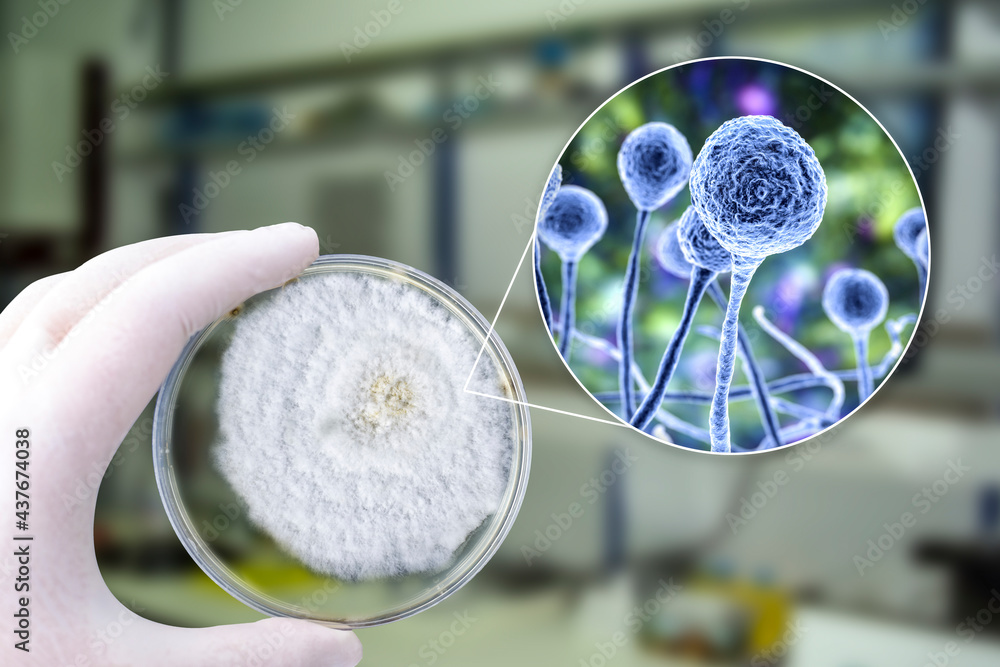 Wall mural colony of mucor fungi grown on petri dish. also known as black fungus, or bread mold.