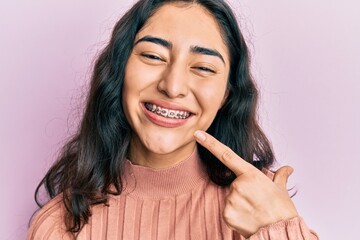 Hispanic teenager girl with dental braces showing orthodontic brackets smiling happy pointing with...