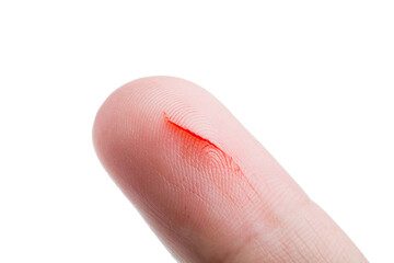 human finger with a cut a consequence of skin damage and open bleeding from a scratch on the...