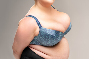 Very large breasts in blue bra, obesity female body on gray background