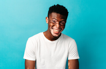 Portrait of a Black man with vitiligo