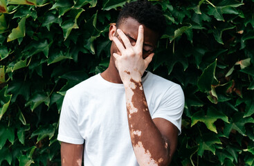 Portrait of a Black man with vitiligo