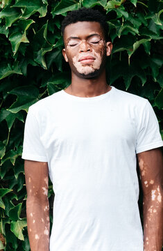 Portrait of a Black man with vitiligo