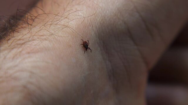 A tick crawls on a man's hairy arm. Macro. Dangerous blood-sucking insect on the human body close-up