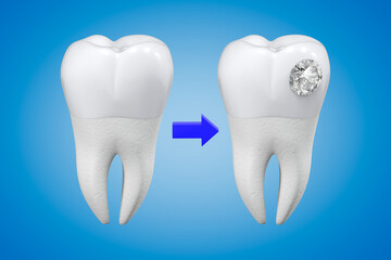 An exaggerated example of a diamond tooth decoration procedure. Aesthetic dentistry. 3d rendering.