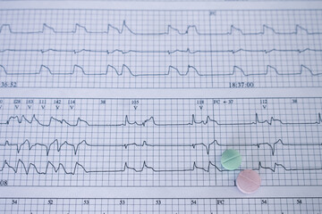 Naklejka premium Medications for the heart on electrocardiograms with arrhythmias. Post covid cardiovascular disease concept.