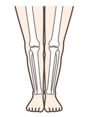Obraz na płótnie Canvas 正常な足　脚、膝の病気の解説用イラスト　