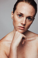 Close up of woman with freckles on body