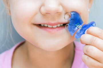 Dental plate. Expansion of the jaw in a child. A plate to heaven. There is not enough room for the molars.