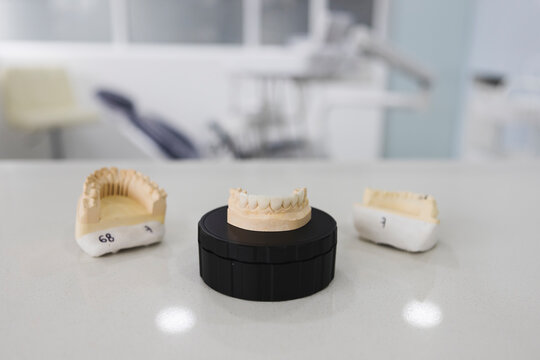 Jaw casts on table in modern hospital