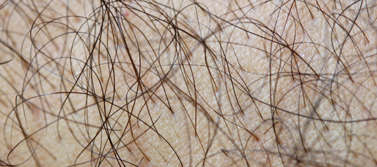 close-up arm hair of a person