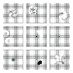 Amsler grid scotoma eye test.  Oculist Vector printable chart retina examination. Grid with dot in centre. Vision control.