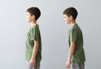 Little boy with proper and bad posture on grey background