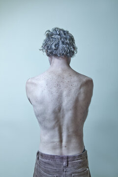 Naked Man, Skin With Freckles, Back Of A Man