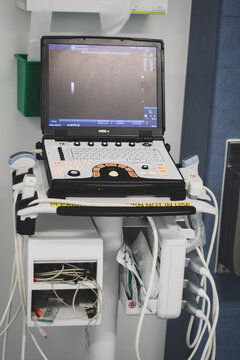 An ultrasound machine on a portable trolley for use in a hospital in clinic, operating theatres and wards.