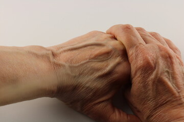 Close up visible veins in an old persons hand, prominent veins  - 438667498