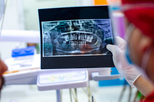 Unrecognizable dentists examining teeth X ray