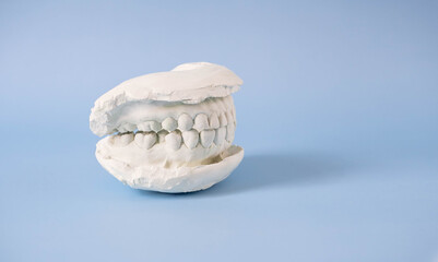 Close up plaster human teeth model and the plaster tooth model placed on the blue background. Dental examination and dental treatment concept. Regular oral health is vital to oral health.