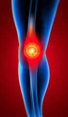 Human knee pain with the anatomy of a skeleton leg