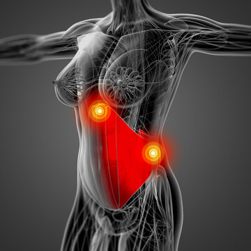 medical  illustration of the transversus abdominis