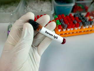 Blood sample for Serum IgG (Immunoglobulin G) test