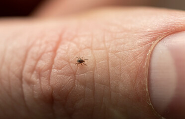Small tick on human finger, danger in forest.