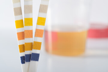 Urine test strip against a urine sample on a white background (vertical, horizontal)