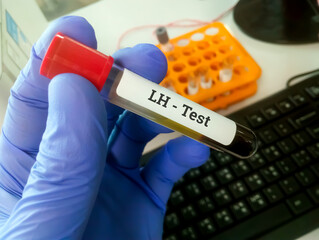 Blood sample tube for luteinizing hormone (LH) test