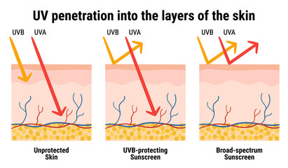 UV penetration into the layers of the skin. Infographic of sunscreen protection against UVA, UVB rays. Skin anatomy. Broad-spectrum sunscreen. Hand drawn vector illustration. - obrazy, fototapety, plakaty