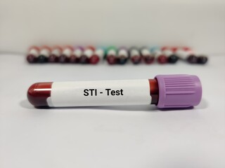 Test Tube with blood sample for STI (sexually transmitted infection) test. - obrazy, fototapety, plakaty