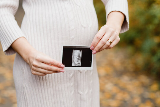 Happy pregnant woman with pregnancy news holding ultrasound baby scan.