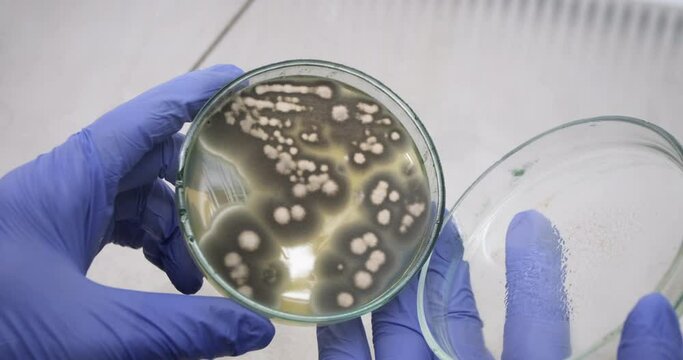 Close-up, a scientist opens a petri dish with his hands with bacteria, fungi that cause allergies in humans.