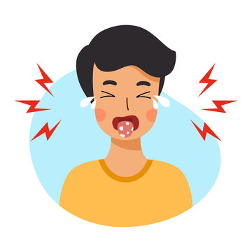 Сhild has stomatitis in mouth. Diseases of oral cavity. Candidiasis in boy.