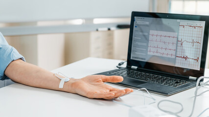 Biofeedback - Female hand with attached sensors for heart rate measurement.
