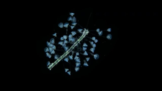 Infusoria Ciliophora Vorticella under the microscope, class Oligohymenophorea.