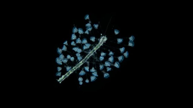 Infusoria Ciliophora Vorticella under the microscope, class Oligohymenophorea.