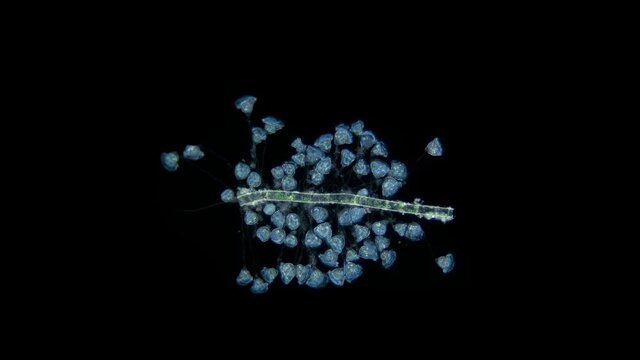 Infusoria Ciliophora Vorticella under the microscope, class Oligohymenophorea.