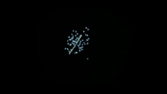Infusoria Ciliophora Vorticella under the microscope, class Oligohymenophorea.